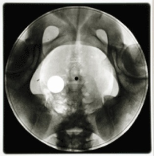 X-ray1.jpg